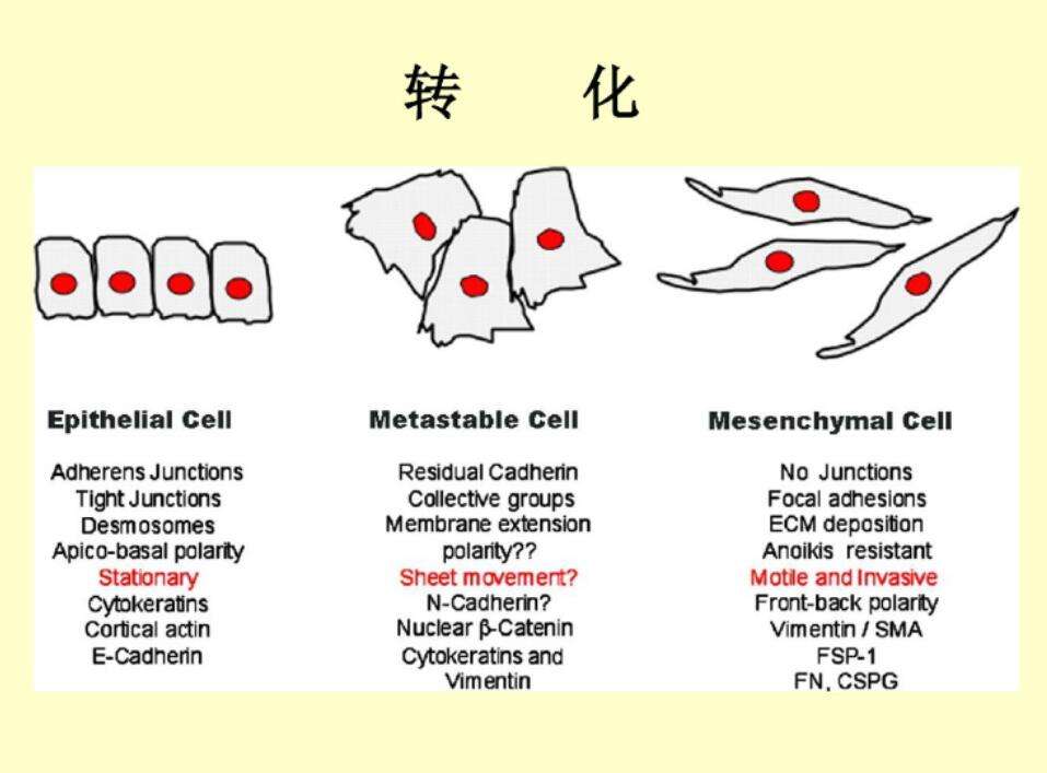 上皮-间质转化与转移：干细胞特性之回归
