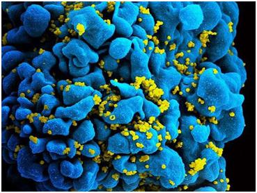 早期抗逆转录病毒治疗可能保留针对HIV的关键免疫反应