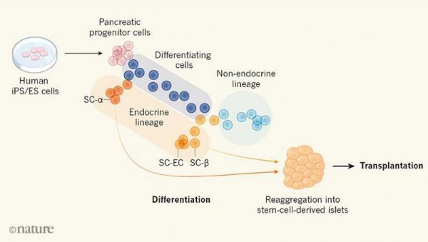 绘制出β细胞分化图谱有望开发出新型糖尿病细胞疗法