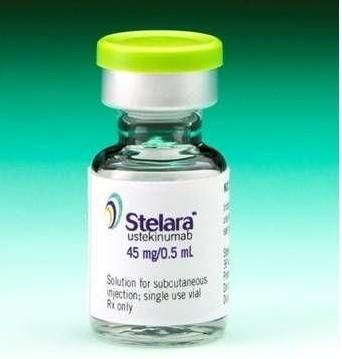 新型抗炎药！强生IL-12/23抑制剂Stelara第4个适应症即将获批，治疗中重度溃疡性结肠炎