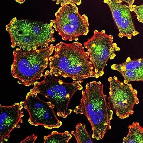 尼古丁通过招募N2嗜中性粒细胞促进乳腺癌的肺转移