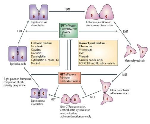白细胞介素8在口腔鳞癌上皮-间充质转化中的研究进展