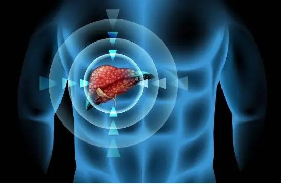 通过切断关键的营养供给链来帮助治疗肝癌