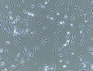 Antcin K抑制滑膜成纤维细胞TNF-α、IL-1、IL-8的表达并改善软骨退化