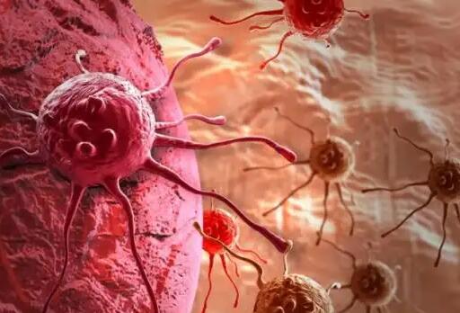 癌细胞竟是催眠高手？将PD-1转移给NK细胞，促使其休眠，失去抗癌能力