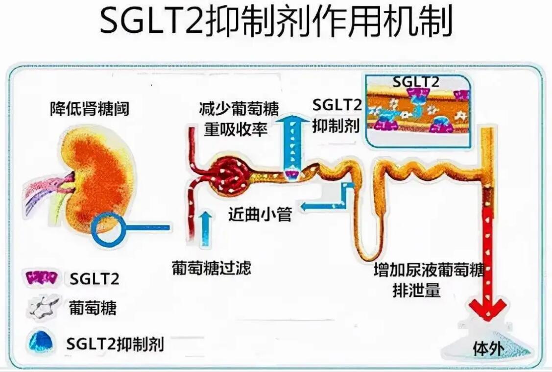 SGLT-2抑制剂应用经验六条，为心衰患者“保驾护航”