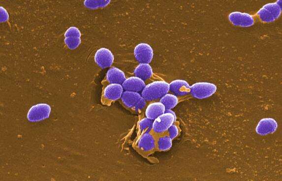 粪肠球菌与口腔微生物相互作用的研究进展